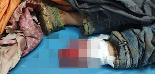 刚到医院情况 刚到医院情况