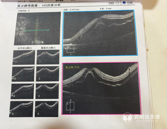 胡女士的检查报告1