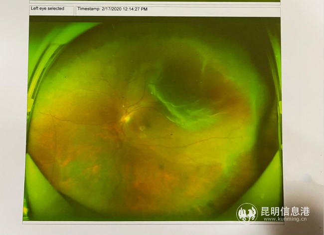 胡女士的检查报告2