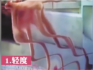 20210705A07_res12_attpic_icon