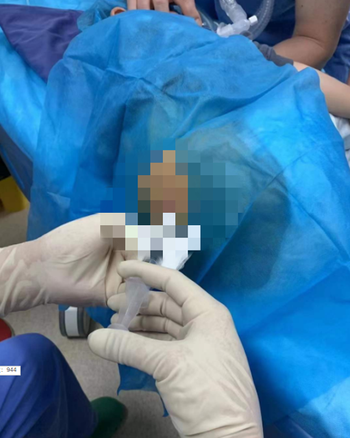 昔日“天价药”纳入医保云南省首例“诺西那生钠注射液”治疗在省一院完成(云南省第一人民医院供图)